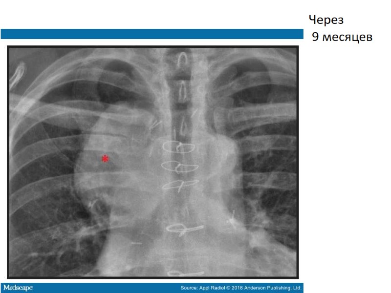 Через  9 месяцев